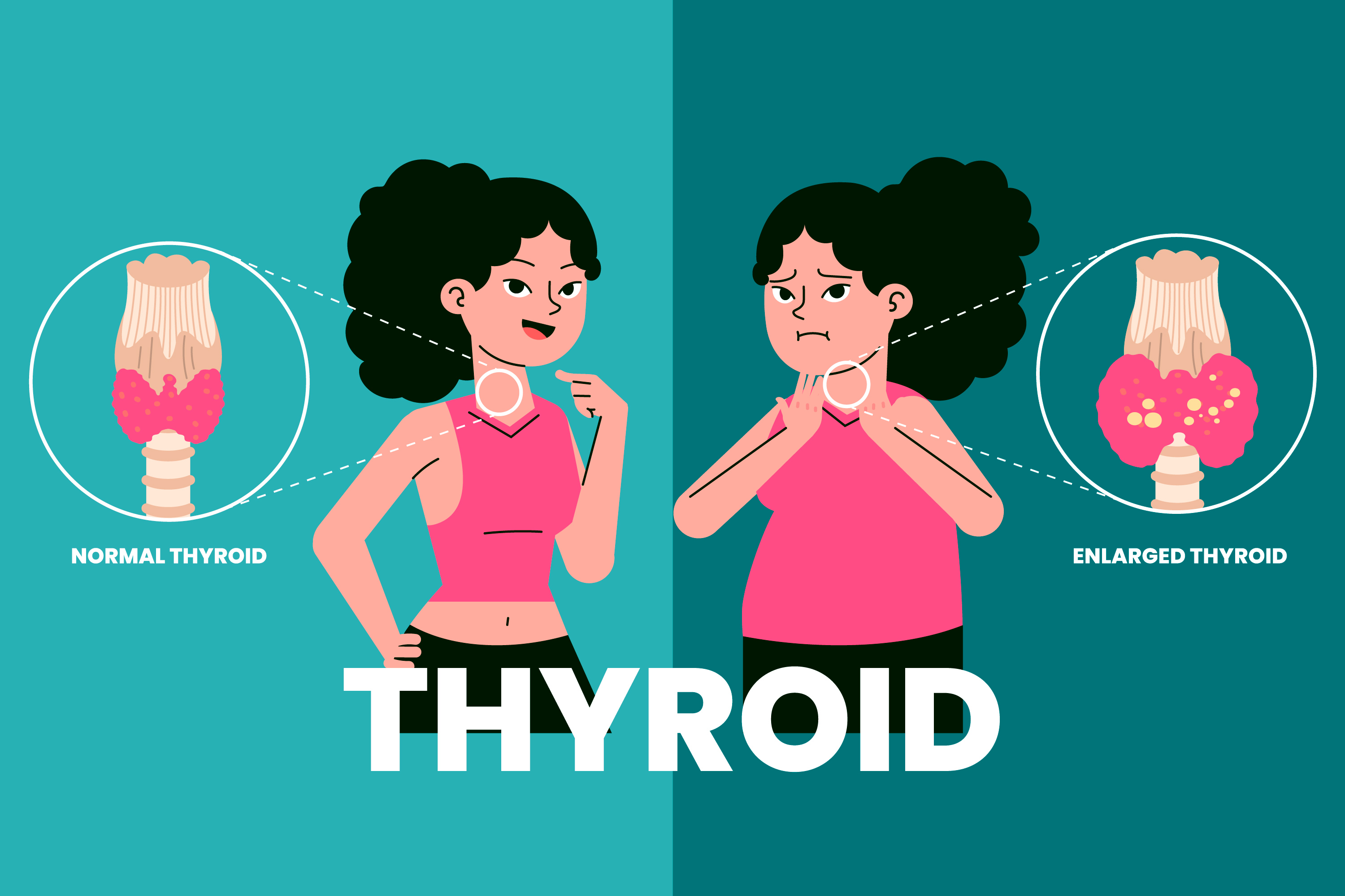 Thyroid Disorder Care (Thyroid Care) at Nakshtra Clinic